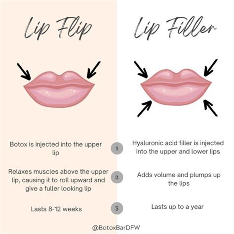 lip flip nyc|The Amazing Botox Lip Flip!